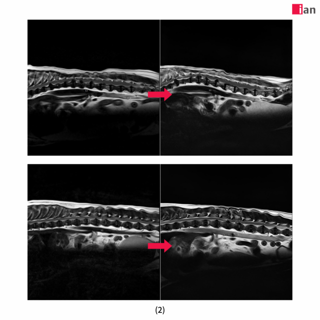 AI 도입 후 품질이 개선된 MRI 영상 사진